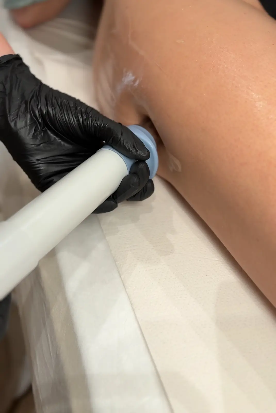 Aparatología estética avanzada en Ikonic Clinic Palma 7