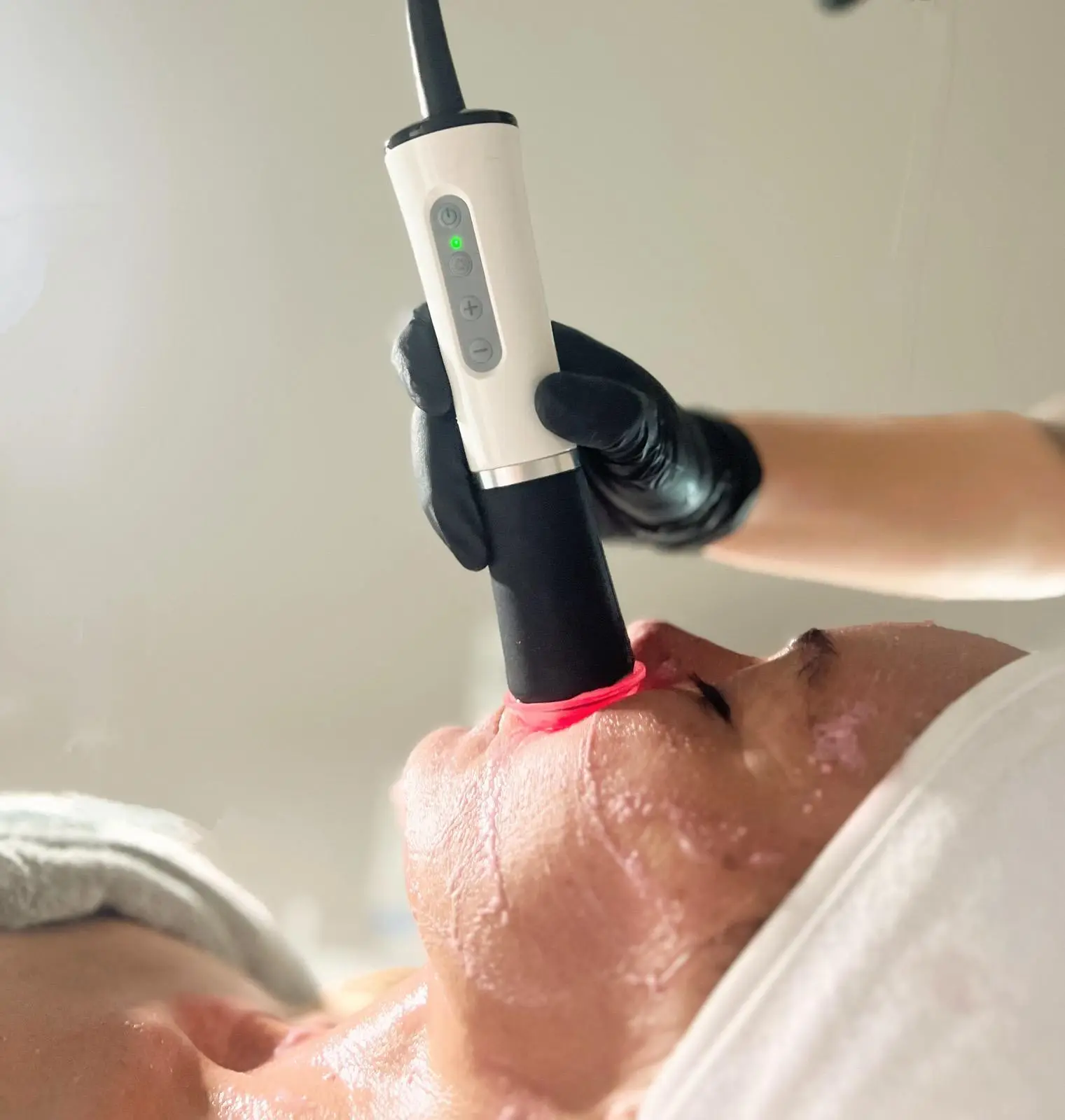 Tratamiento estético y de aparatología en Ikonic Clinic Palma 4