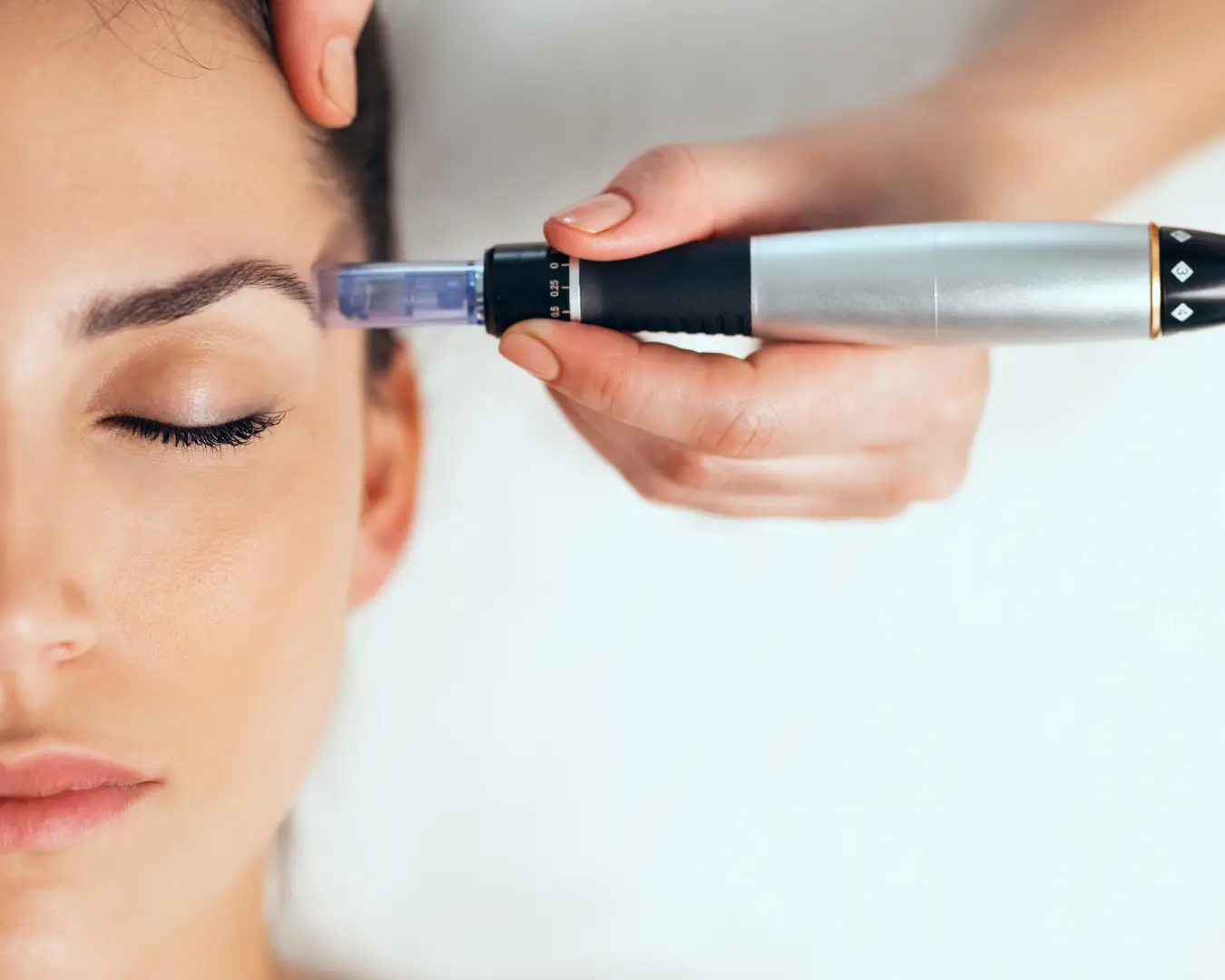 Tratamiento estético y de aparatología en Ikonic Clinic Palma 6