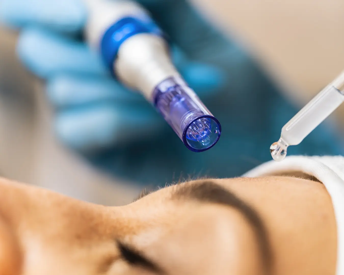 Tratamiento estético y de aparatología en Ikonic Clinic Palma 9