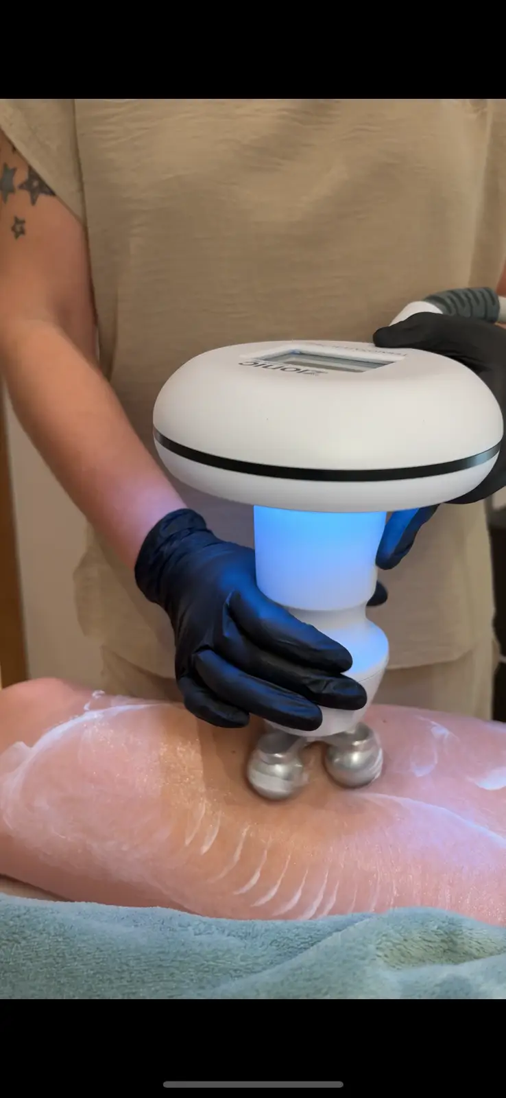 Aparatología estética avanzada en Ikonic Clinic Palma 13