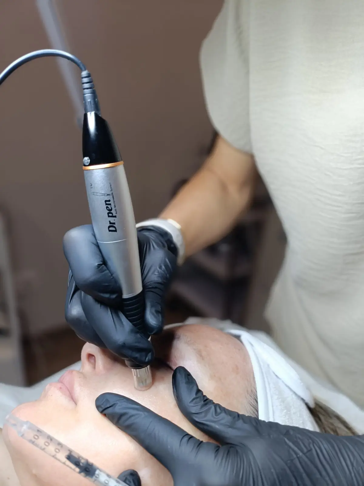 Tratamiento médico-estético en Ikonic Clinic Palma 21